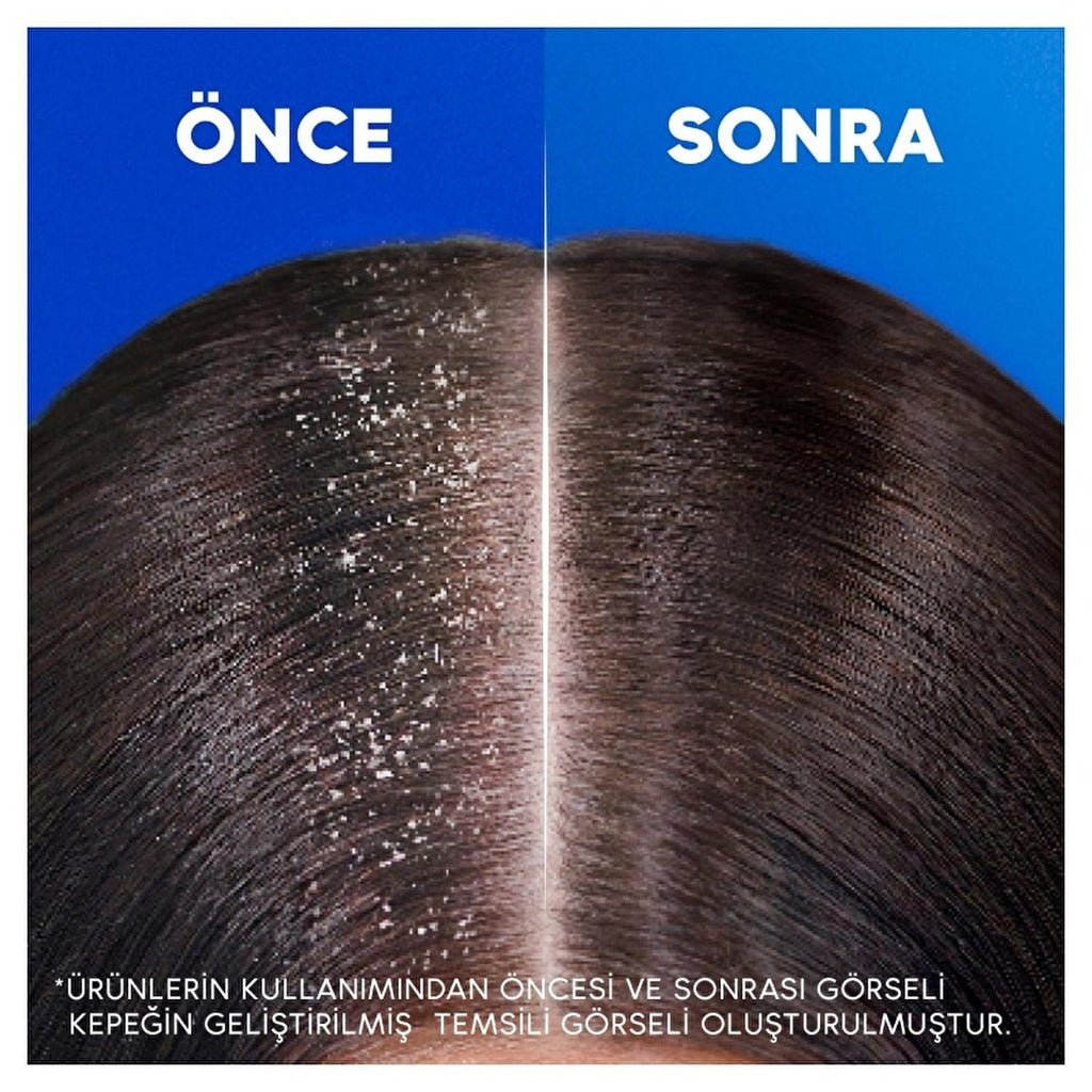 Head & Shoulders Anti-Dandruff Shampoo with Coconut Oil - Moisturizing, Dermatologically Tested - 11.16 fl oz